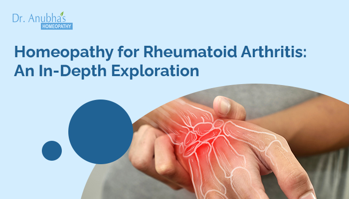 Homeopathy for Rheumatoid Arthritis